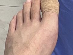 -Andrew指甲专科灰指甲·甲沟炎矫正·3D步态矫形鞋垫定制(浦三路店)