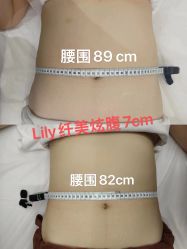 -Lily纤美·科技减脂中心