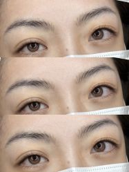 点击看大图 -杨益美学·野生眉半永久纹眉发际线