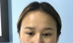 -Doris多里斯半永久纹眉·SMP纹发·发际线