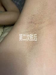 -西安壹加壹医疗美容·西北抗衰旗舰店
