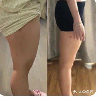 Lily纤美·科技减脂中心(相城天虹店)图片
