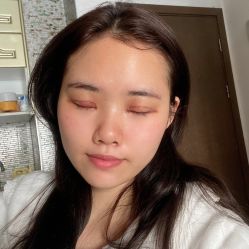 体验后-广州美莱医疗美容医院