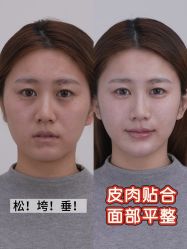 -Yestar重庆艺星医疗美容医院
