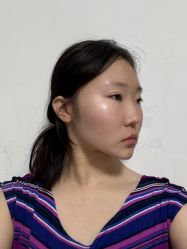 -四川米兰柏羽医学美容医院
