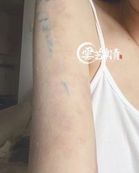 -雲艺刺青·洗纹身