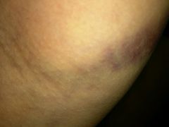 -北京中西医结合医院