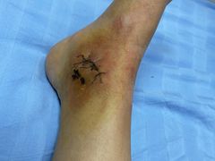 -成都市第一人民医院(南区)