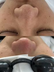 -Return·蕾特恩祛痘·皮肤管理中心