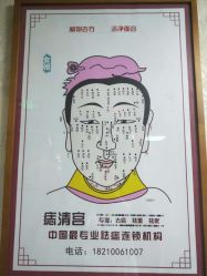 -痣清宫祛斑祛痣连锁店