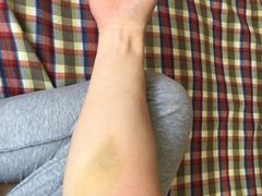 -天津市黄河医院