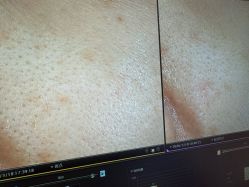 -苑苑vbeauty科技美容SPA