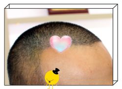 -大麦微针植发全国连锁