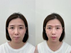-Yestar艺星医疗美容医院
