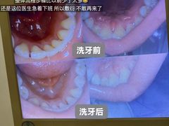 -圣呗口腔·舒适化种植牙·矫正中心(广州总院)