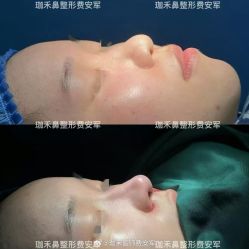 -JustHer宁波珈禾医疗美容医院