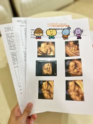 -艾博尔医院