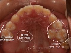 -柏乐口腔(南宁总院)