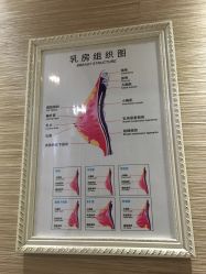 -成都伊贝丝美容美胸SPA会所