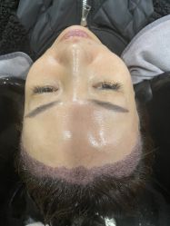 -熙朵美学植发·连锁品牌