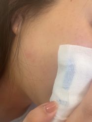 -素美医疗美容·西南眼鼻整形·修复基地
