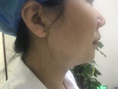 -柏乐口腔(南宁总院)