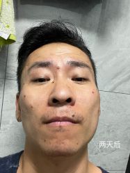 体验后-上海锦妍医疗美容门诊部