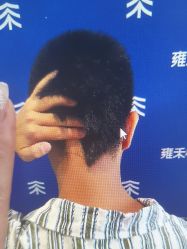 -雍禾植发全国连锁