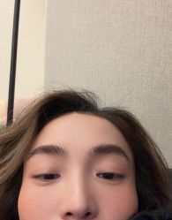 -天津健丽·去眼袋医疗美容机构