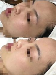 -LUNA皮相美·骨相美高级美感