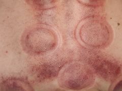 -安琪盲人按摩调理草本熏蒸馆(风和日丽店)