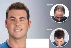 -发饰美男士增发补发假发定制店