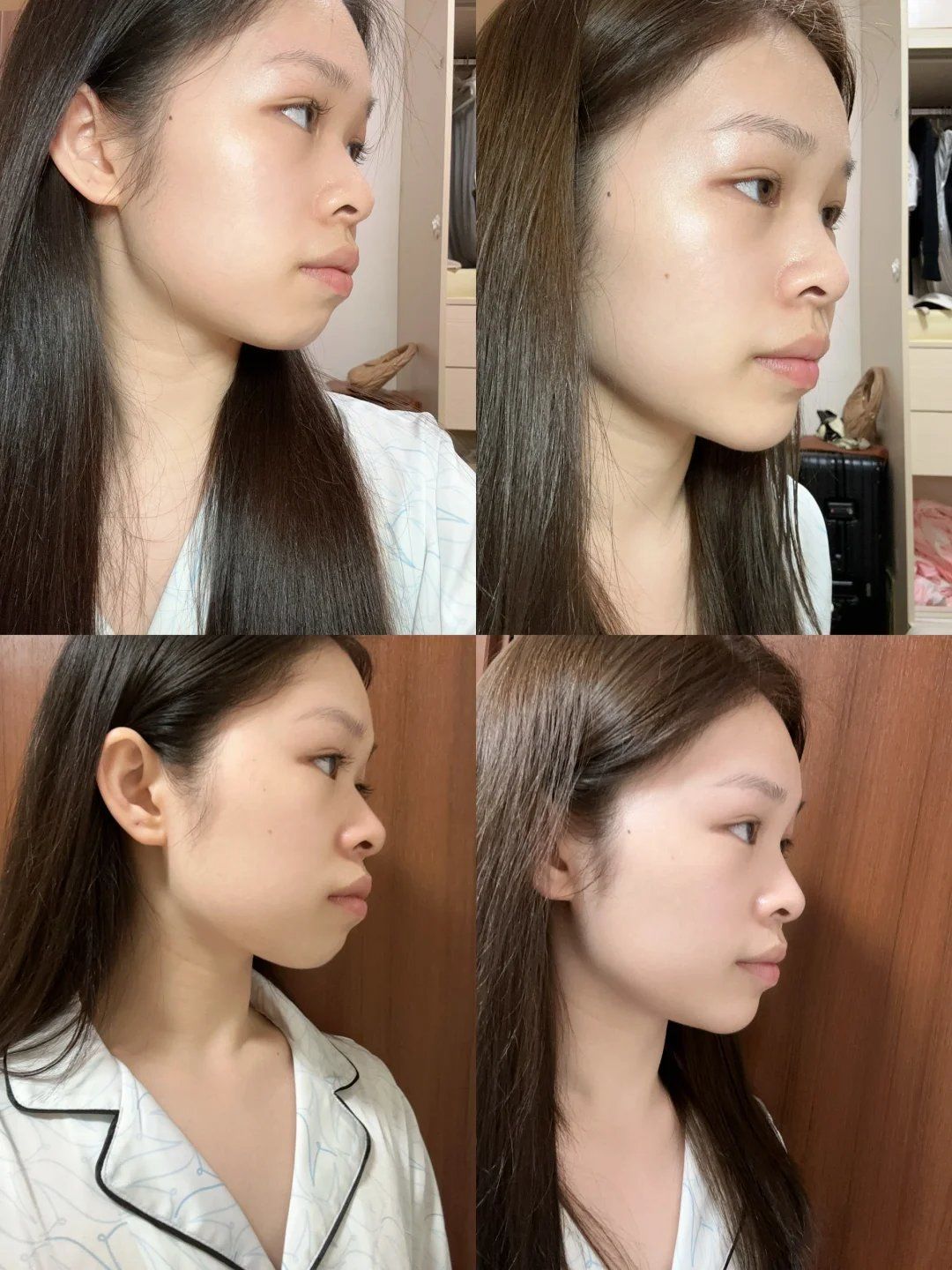 郭亚宁老师正品五行健脾散