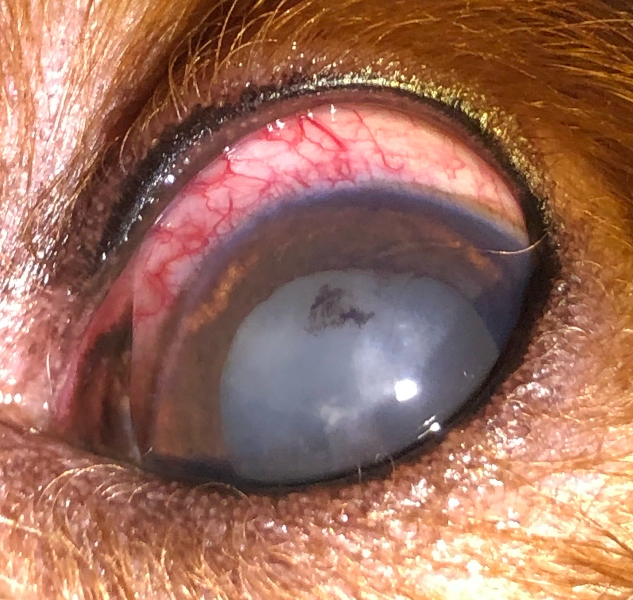 它是眼睛的晶状体逐渐变得模糊,导致视力模糊和眼球透视度下降的情况.