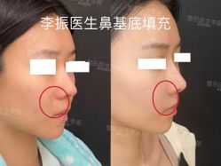 -北京米扬丽格医疗美容·联合丽格鼻整形中心