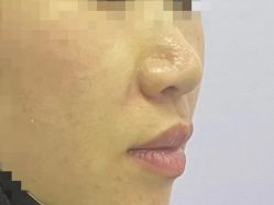 -东剑医学美容·注射美学中心