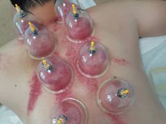 -感智盲人按摩·艾灸·肩颈SPA(岗厦店)