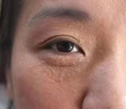 -+MS卓美丝专业祛痘·皮肤管理中心