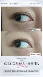 -MeVius 美薇私·皮肤管理中心