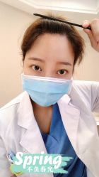 体验后-大麦微针植发全国连锁