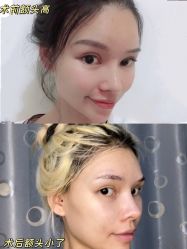 -上海玫瑰医疗美容医院
