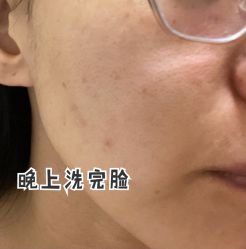 体验后-北京米扬丽格医疗美容·联合丽格鼻整形中心
