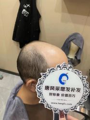 -唐风采假发补发定制