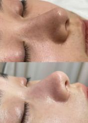 -美愈美肤MEIYU SKIN