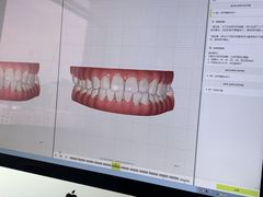 -Dr.Z dental仁康种植矫正中心