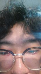 -八大处整形