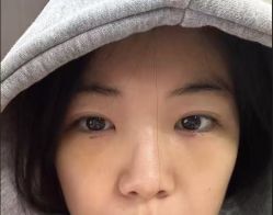 -天津健丽·去眼袋医疗美容机构
