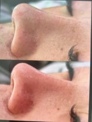 -skin79皮肤管理中心