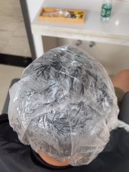 -雍禾植发