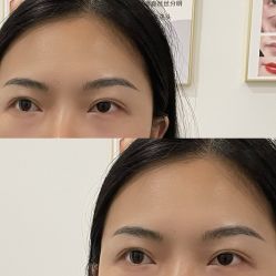 点击看大图 -杨益美学·野生眉半永久纹眉发际线